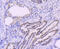 DNA Polymerase Beta antibody, GTX00983, GeneTex, Immunohistochemistry paraffin image 