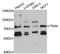 Tensin 4 antibody, STJ111391, St John