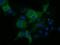 Kelch Like Family Member 2 antibody, NBP2-02939, Novus Biologicals, Immunofluorescence image 