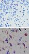 Ta1 antibody, NBP2-24714, Novus Biologicals, Immunohistochemistry paraffin image 