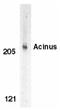 Apoptotic Chromatin Condensation Inducer 1 antibody, LS-C328, Lifespan Biosciences, Western Blot image 