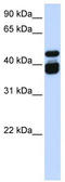 T-box transcription factor TBX6 antibody, TA344466, Origene, Western Blot image 