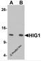 HIG1 Hypoxia Inducible Domain Family Member 1A antibody, 6489, ProSci, Western Blot image 