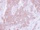 CD81 Molecule antibody, NBP2-20564, Novus Biologicals, Immunohistochemistry frozen image 