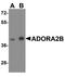 Adenosine A2b Receptor antibody, PA5-72850, Invitrogen Antibodies, Western Blot image 