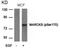 Myristoylated Alanine Rich Protein Kinase C Substrate antibody, 79-246, ProSci, Western Blot image 