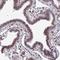 RNA Binding Protein, MRNA Processing Factor antibody, NBP2-33810, Novus Biologicals, Immunohistochemistry paraffin image 