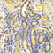 Eukaryotic Translation Initiation Factor 5A antibody, A2016, ABclonal Technology, Immunohistochemistry paraffin image 