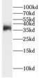 GDNF family receptor alpha-2 antibody, FNab03439, FineTest, Western Blot image 