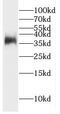 GDNF Family Receptor Alpha 2 antibody, FNab03439, FineTest, Western Blot image 