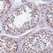 HECT Domain E3 Ubiquitin Protein Ligase 4 antibody, HPA041062, Atlas Antibodies, Immunohistochemistry frozen image 