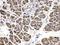 Amylase Alpha 1C (Salivary) antibody, A12967, Boster Biological Technology, Immunohistochemistry paraffin image 