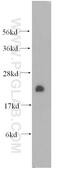 Cysteine Rich Protein 2 antibody, 51102-1-AP, Proteintech Group, Western Blot image 