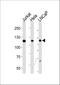 Ubiquitin Specific Peptidase 11 antibody, M05225-1, Boster Biological Technology, Western Blot image 