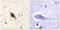 Sodium Channel Epithelial 1 Beta Subunit antibody, LS-C822950, Lifespan Biosciences, Immunohistochemistry paraffin image 