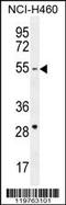 CD2 Cytoplasmic Tail Binding Protein 2 antibody, MBS9211791, MyBioSource, Western Blot image 