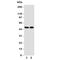 Vitamin D Receptor antibody, R31089, NSJ Bioreagents, Western Blot image 