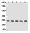 Tissue factor pathway inhibitor 2 antibody, PA1248, Boster Biological Technology, Western Blot image 