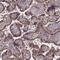 MYC Binding Protein antibody, NBP1-89101, Novus Biologicals, Immunohistochemistry paraffin image 