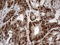 RNA Transcription, Translation And Transport Factor antibody, LS-C338983, Lifespan Biosciences, Immunohistochemistry frozen image 