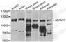 ADAM Metallopeptidase Domain 17 antibody, A0821, ABclonal Technology, Western Blot image 