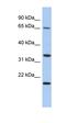 Tumor Protein P63 Regulated 1 antibody, orb326043, Biorbyt, Western Blot image 