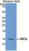 Eukaryotic Translation Initiation Factor 4E Binding Protein 1 antibody, LS-C293801, Lifespan Biosciences, Western Blot image 