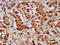 Laminin Subunit Gamma 2 antibody, LS-C674986, Lifespan Biosciences, Immunohistochemistry paraffin image 