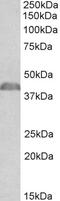 Oncostatin M Receptor antibody, 43-190, ProSci, Western Blot image 