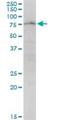 Poly(A)-Specific Ribonuclease antibody, H00005073-B01P, Novus Biologicals, Western Blot image 