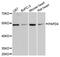 Terminal Nucleotidyltransferase 2 antibody, LS-C748299, Lifespan Biosciences, Western Blot image 