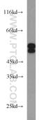 SH2 Domain Containing 4A antibody, 15957-1-AP, Proteintech Group, Western Blot image 