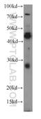 Sperm Acrosome Associated 3 antibody, 21137-1-AP, Proteintech Group, Western Blot image 