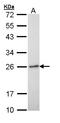 RAB6A, Member RAS Oncogene Family antibody, LS-B10800, Lifespan Biosciences, Western Blot image 