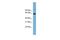 Ligand Dependent Nuclear Receptor Corepressor Like antibody, GTX49087, GeneTex, Western Blot image 