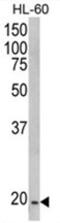 NADH:Ubiquinone Oxidoreductase Subunit S4 antibody, AP17586PU-N, Origene, Western Blot image 