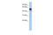 Lactate Dehydrogenase D antibody, 31-302, ProSci, Western Blot image 