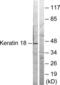 Keratin 18 antibody, LS-C117526, Lifespan Biosciences, Western Blot image 