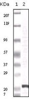 Fibroblast Growth Factor 2 antibody, abx010777, Abbexa, Enzyme Linked Immunosorbent Assay image 