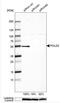 DNA Polymerase Delta 2, Accessory Subunit antibody, NBP1-90925, Novus Biologicals, Western Blot image 