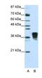 Transformer 2 Beta Homolog antibody, orb324871, Biorbyt, Western Blot image 