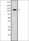 ADAM Metallopeptidase With Thrombospondin Type 1 Motif 17 antibody, orb337970, Biorbyt, Western Blot image 