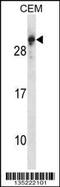 Regulator Of G Protein Signaling 5 antibody, 58-079, ProSci, Western Blot image 