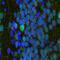 Adenylate Cyclase 3 antibody, M04795, Boster Biological Technology, Immunohistochemistry paraffin image 