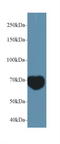 Mindbomb E3 Ubiquitin Protein Ligase 2 antibody, LS-C295379, Lifespan Biosciences, Western Blot image 