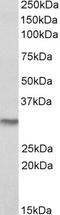 NAD(P)H Quinone Dehydrogenase 1 antibody, LS-B8354, Lifespan Biosciences, Western Blot image 