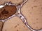 Thyroglobulin antibody, LS-C339047, Lifespan Biosciences, Immunohistochemistry frozen image 
