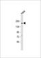 c-Kit antibody, GTX81335, GeneTex, Western Blot image 