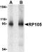 CD180 antigen antibody, LS-B2693, Lifespan Biosciences, Western Blot image 