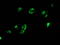 MYD88 Innate Immune Signal Transduction Adaptor antibody, M00025-4, Boster Biological Technology, Immunofluorescence image 